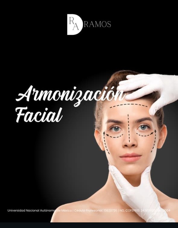 Armonización facial