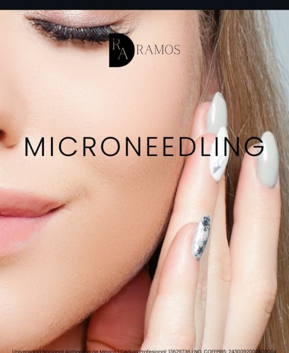 Microneedling — inducción de colágeno