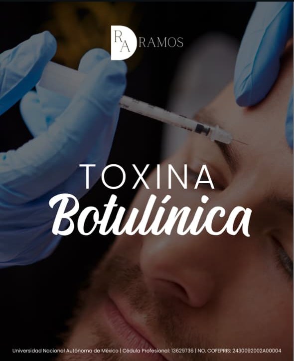 Toxina botulínica — aplicación en el rostro